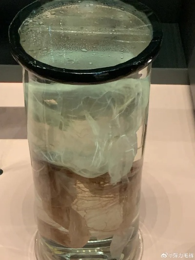 (福尔马林百度百科)福尔马林63集免费!快来体验惊心动魄的剧情 (福尔马林百度百科)福尔马林63集免费!快来体验惊心动魄的剧情